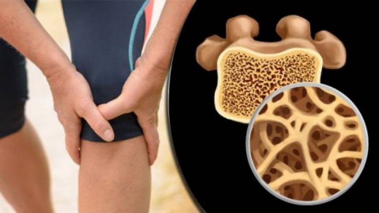 ممارسة المشي أفضل وقاية من هشاشة العظام