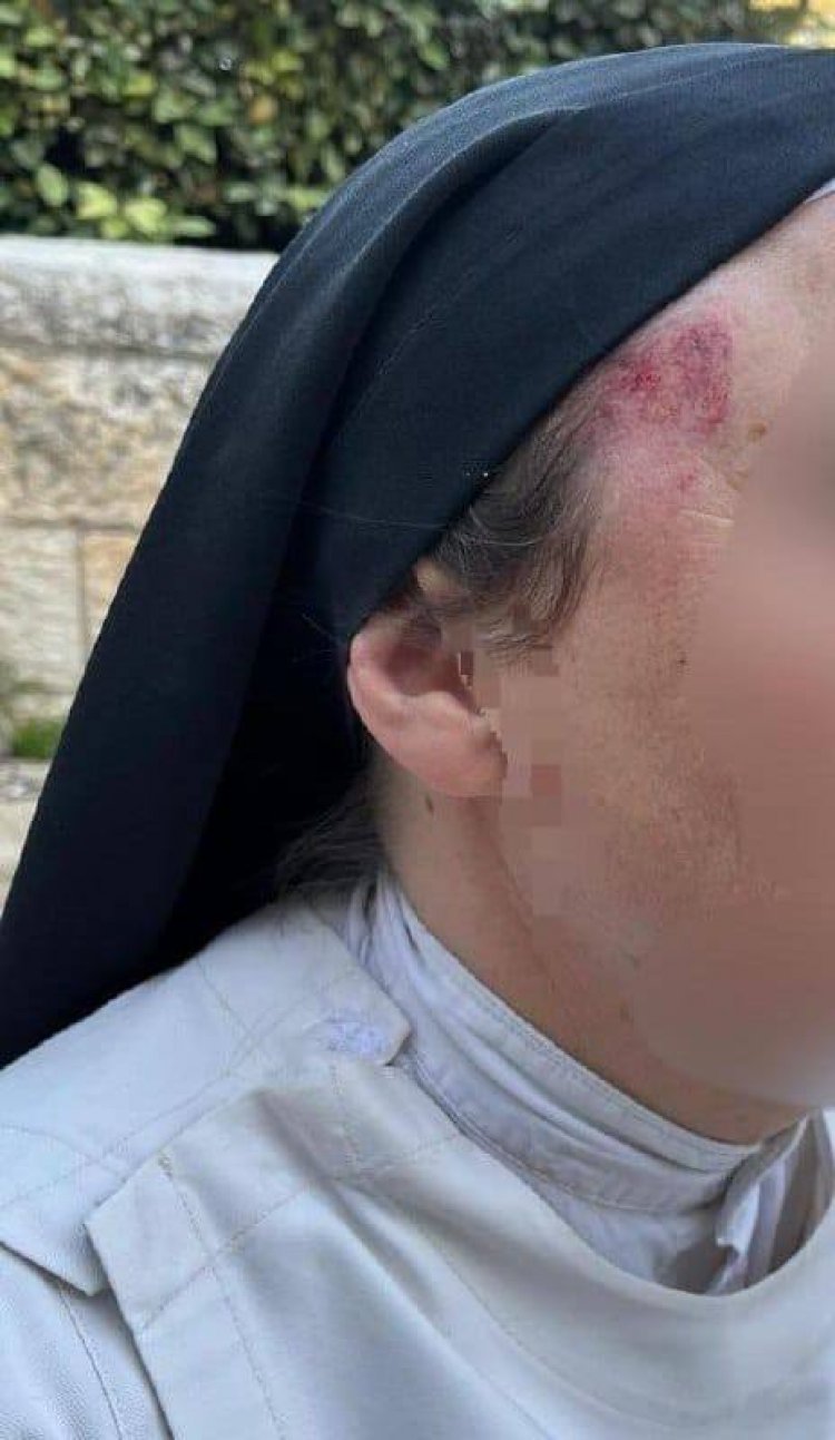حين تُضرب الراهبة… تُفضَح المدينة
